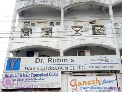 Dr Rubins Hair Restoration Clinic - Hair Transplantation Clinic in  Secunderabad,Telangana | Pointlocals