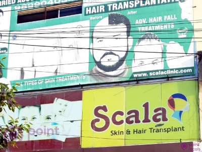 Scala Skin & Hair Transplant - Hair Transplantation Clinic in  Hyderabad,Telangana | Pointlocals